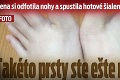 Žena si odfotila nohy a spustila hotové šialenstvo na internete: Takéto prsty ste ešte nevideli!