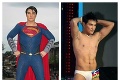 Podstúpil 23 operácií, aby vyzeral ako Superman: Pozrite sa, ako vyzerá teraz!
