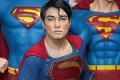 Podstúpil 23 operácií, aby vyzeral ako Superman: Pozrite sa, ako vyzerá teraz!