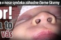 Matka spozorovala v nose synčeka záhadne čierne škvrny: Pozor! Môže sa to týkať aj vás