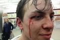 Takúto (ne)hokejovú bitku ste ešte nevideli: Hráči sa pobili mimo ihriska, zasiahnuť musela polícia!