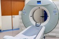Počítačová tomografia oslavuje 40-tku: Takto nám CT-čko sleduje orgány