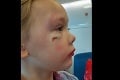 Dievčatko skončilo v nemocnici so škaredou ranou: Poznámka zdravotníka jeho mamičku rozzúrila!