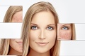 7 varovných signálov, ktoré musíte zbadať: Tvár odráža vaše zdravie aj choroby!
