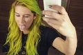 Kesha predviedla doteraz najšialenejšiu farbu vlasov: Fúú, s takým három ju nikto neprehliadne!