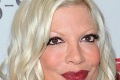 Tori Spelling spadla na rozpálený gril: Transplantácia kože!