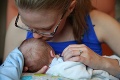 Keď matka uvidela novorodeniatko, zostala v šoku: Šanca, že sa také narodí, je 1:197 miliónom!