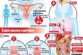Angelina urobila radikálny krok: Dokáže odstránenie vaječníkov naozaj zachrániť ženy pred rakovinou?