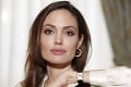 Angelina Jolie po odstránení prsníkov opäť šokovala: Dobrovoľne sa vzdala výsady každej ženy!