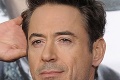 Alexovi daroval ruku Robert Downey jr.: Ak protéza, tak od Iron Mana!