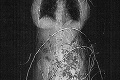 Lekári zostali ako obarení: Pohľad na röntgen tejto ženy naháňal husiu kožu