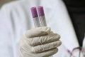 Lekári majú podozrenie na ďalší prípad prasacej chrípky na Slovensku, očkovanému dievčatku zas zistili mumps