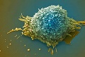Ako vzniká rakovina? Českí vedci prišli s prelomovým objavom!