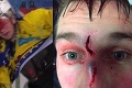 Krvavé divadlo: Nespravodlivá hokejová pomsta sa skončila hrozivo