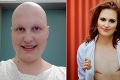 Krásnu Nikolu potrápila rakovina a prišla o oba prsníky: Reakcia priateľa ju dostala!