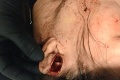 Vyslovený HNUS v ženskom ringu: Bojovníčka odtrhla súperke ucho!