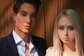 Novými fotkami vydesila fanúšikov: Živá Barbie Valeria prišla o svoju dokonalú tvár a skoro aj o život!