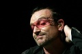 Tajomstvo tmavých okuliarov odhalené: Bono Vox prezradil, že ich nenosí len pre parádu!