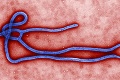 Už aj Rakúsko! U našich západných susedov preverujú dva prípady podozrenia na ebolu
