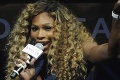Serena Williamsová má nového najlepšieho kamaráta: Volá  sa alkohol a dorobil s ňou TOTO!