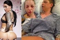 Pornoherečku brutálne zmlátil jej expriateľ: Zlomil jej kosti, nos a oskalpoval hlavu!
