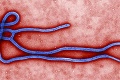 Svet straší smrtiaci vírus: Dostane sa ebola do Európy?