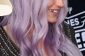 Speváčka Kesha opeknela, ale keď sa usmeje... Imidž krásky je razom fuč! Prečo?