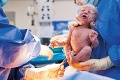 Zázrak v Maďarsku:  Mamička († 31) porodila zdravé dieťa tri mesiace po smrti!