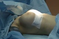 Prvé foto Plačkovej pýchy po plastickej operácii: Žiadne desiatky nemá!