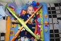 Malý Matejko má iba 8 mesiacov a za sebou už 5 operácií!