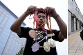 Čínsky gymnasta skončil po zranení na ulici: Cvičí a žobre, aby prežil