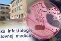 Prešovčan nakazený E.coli: Muž nemá smrtiacu baktériu!