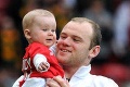 Je z neho fešák! Rooneyho stáli umelé vlasy 35 tisíc eur