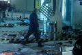 Útok v Moskve: Rusi zverejnili fotku zohavenej hlavy teroristu!