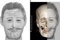 Historický objav: Našli odseknutú hlavu francúzskeho kráľa Henricha IV.