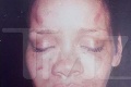 VIDEO - Zmlátená Rihanna: Po bitke chce Chrisa späť! Zbláznila sa?