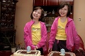 VIDEO: Siamske dvojčatá Lucia a Andrejka oslávili 9 rokov