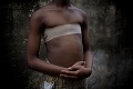 Brutálna tvár Afriky: Dievčatkám 