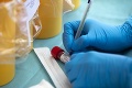 Odhalia naše laboratóriá anglický kmeň koronavírusu? Hygienici reagujú