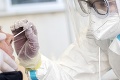 Belgicko skúma novú metódu testovania na koronavírus: Výter z nosohltana má nahradiť niečo úplne iné