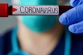 Koronavírus stále najviac vystrája v USA: Počet obetí už prekročil hranicu 100-tisíc