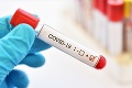 Taliansko má 593 nových prípadov nákazy koronavírusom, drvivú väčšinu z jedného regiónu