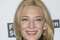 Herečka Cate Blanchett vystrašila fanúšikov: Zranenie hlavy motorovou pílou