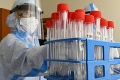 Úrad verejného zdravotníctva analyzoval vzorky na britskú mutáciu koronavírusu: Znepokojujúce zistenie