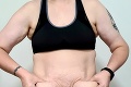 Úžasná premena, za rok schudla 54 kíl: Ako to dokázala? Mamička sa podelila o tajomstvo úspechu