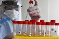 Testovanie v Brezovej pod Bradlom odhalilo 22 pozitívnych: Prekvapivé výsledky PCR testov