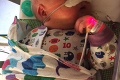 Senzácia po pôrode! Pohľad na novorodenca zaskočil aj lekárov: Takéto bábätko ste ešte nevideli