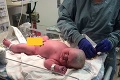Senzácia po pôrode! Pohľad na novorodenca zaskočil aj lekárov: Takéto bábätko ste ešte nevideli