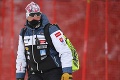 Bývalý švajčiarsky lyžiar varuje pred Magonim: Môžete si na ňom rýchlo spáliť prsty!