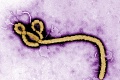 Znepokojivé zistenie o novom výskyte eboly: Vedci majú veľké množstvo otázok